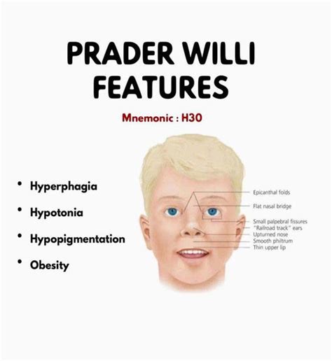 prader willi's disease symptoms